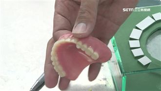 男假牙斷裂卡喉嚨　警馳援開車送醫