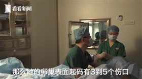卵子,取卵,手術　圖／翻攝自陸媒看看新聞www.kankanews.com
