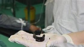 陰莖,陜西,鐵環,生殖器,角磨機,消防隊/翻攝自《中國報》