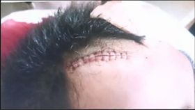 警察 蘆洲 砍傷 警方提供