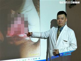 醫師鄭志堅提醒，若發現反覆口腔、會陰潰瘍，應盡早就醫檢查，可能是「絲路病」徵兆。（圖／記者楊晴雯攝）