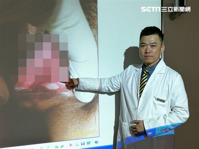 嘴破、下體永潰爛..她竟得不治之症