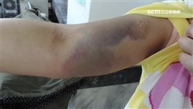 惡姪子假意幫喬債 親姑姑遭囚虐打還餵毒