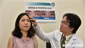 接受提眼肌支持韌帶懸吊手術後，潘同學的左眼已能和右眼對稱，也順利重建眨眼功能。（圖／雙和醫院提供）