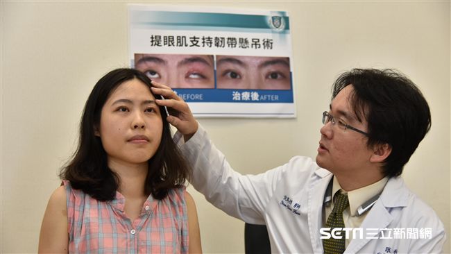 不是睡不飽！她患這病眼皮老是垂垂