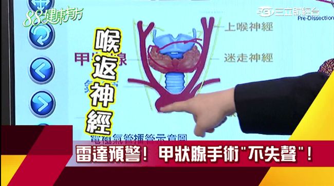 身體的神祕蝴蝶結　甲狀腺亢進有解？