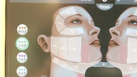 音波研討會1924 0913 e18