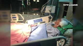 不滿酒後挨巴掌　男子持刀猛砍同學爸