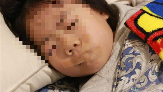 膠帶封嘴4歲女兒　鰻魚媽：矯正呼吸