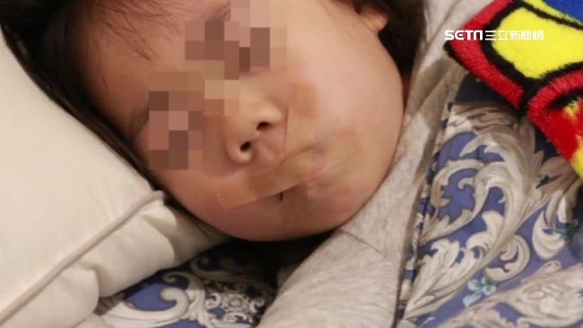 打呼、磨牙要注意　恐成「長臉症」！