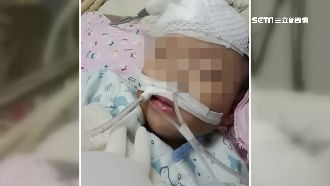 1歲女嬰遭安置頭傷開刀　父疑被虐待