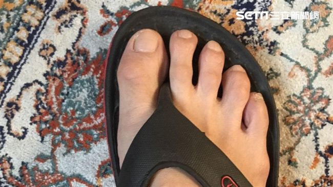 婦被廁所門刮傷　北捷判賠6070元