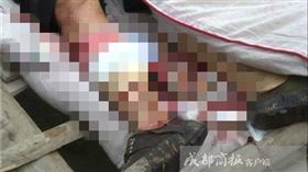 中國大陸,四川,茶農,茶葉,修剪,割灌機,意外(微博 http://www.weibo.com/ttarticle/p/show?id=2309351000134097545663035776)