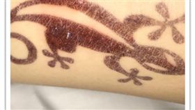 峇里島,畫刺青,接觸性皮膚炎,PPD,對苯二胺(爆料公社)