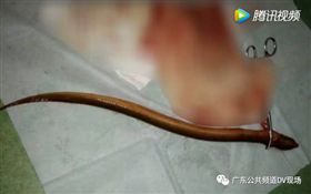 男相信偏方，拿鱔魚塞肛門通便險死。翻自《廣州日報》