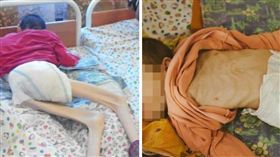 白俄羅斯,孤兒院,營養不良,皮包骨,餓死,募款,骨瘦如柴
（圖／翻攝自imenamag）