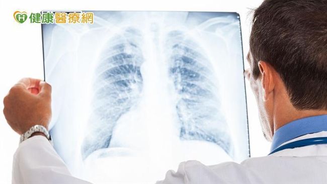 肺癌新化療藥物　醫囑性高、副作用少