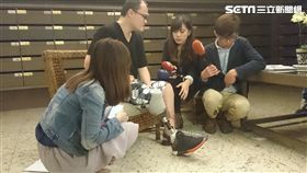 陳昭宏向記者說明腿部傷勢及復健狀況。（圖／記者游承霖攝）