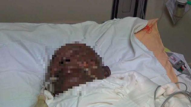 懷疑被友人出賣　男縱火活活燒死對方