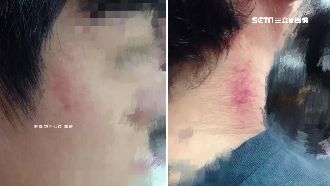 打牌太吵釀衝突？里長遭控毆打兒同學