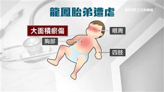 男嬰哭鬧擾午睡　新手爸狠毆顱內出血