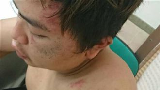 遭女網友設計仙人跳　男子遭拘禁爆打