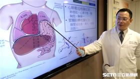 醫師黃宏昌表示，這名八十多歲男性患者，因橫隔膜的「隔間」功能未能發揮，胃腸被擠到心臟後面，導致急性阻塞與黏膜壞死。（圖／台北醫學大學附設醫院提供）