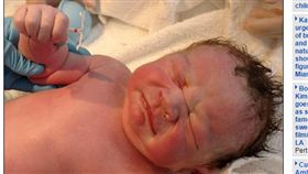 男嬰,剖腹,子宮避孕器,懷孕,婦產科,尹長生,避孕/每日郵報
