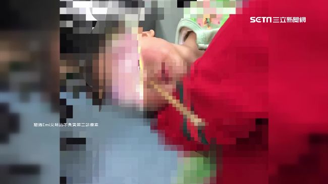 筷插入幼童腦門　醫生警告別做這件事