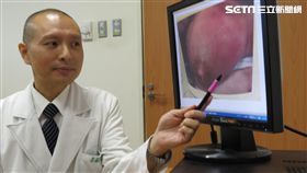 月子餐太營養！哺乳媽咪三個月5次乳腺炎（圖／台中慈院提供）