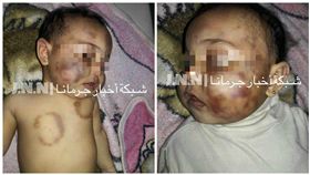 敘利亞，女嬰，虐死（圖／翻攝自J.N.N臉書）