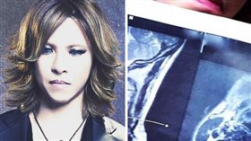 X JAPAN,YOSHIKI,頸椎,手術,鼓手,團長
（圖／翻攝自YOSHIKI IG）