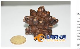 怎麼長這樣？陸7旬老翁膀胱結石　取出後醫護人員嚇傻
圖／翻攝自東莞陽光網
http://news.sun0769.com/town/ms/201705/t20170511_7361345.shtml