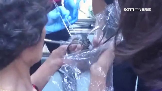 一手夾2個捕鼠夾！7旬嬤痛得哇哇叫