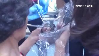 一手夾2個捕鼠夾！7旬嬤痛得哇哇叫