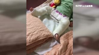 撞斷2歲童腿骨　惡騎士留假電話逃逸