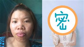 郭金鳳,整型, 圖／翻攝自kenh14