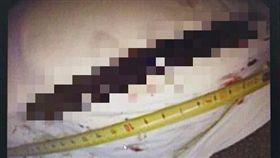 16:9
為了打賭…陸男生吞16公分長筷子　造成十二指腸潰瘍
圖／翻攝自楚天都市網
http://www.ctdsb.net/html/2017/0515/hubei93929.html