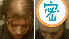 禿頭，髮型（圖／翻攝自《boredpanda》網站）