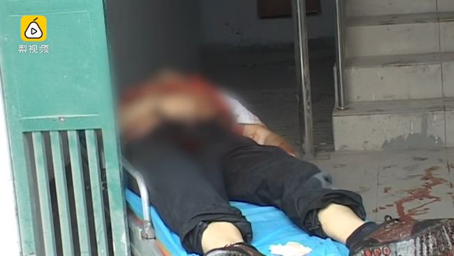 他裝修新家　慘用電鋸割斷自己氣管亡
