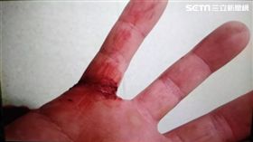 吳姓警員右小指遭嫌犯砍傷流血。（圖／翻攝畫面）