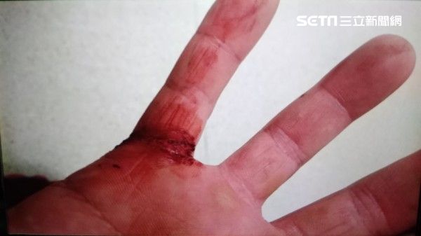 大尾！通緝犯拒捕竟揮刀砍員警