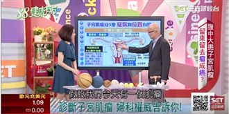 婦科子宮肌瘤　留來留去「瘤」成癌？