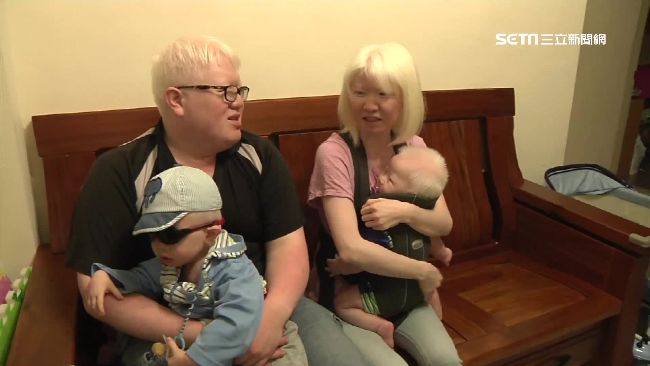 不畏異樣眼光　白化患者共組家庭生子