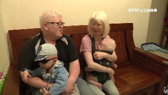 不畏異樣眼光　白化患者共組家庭生子