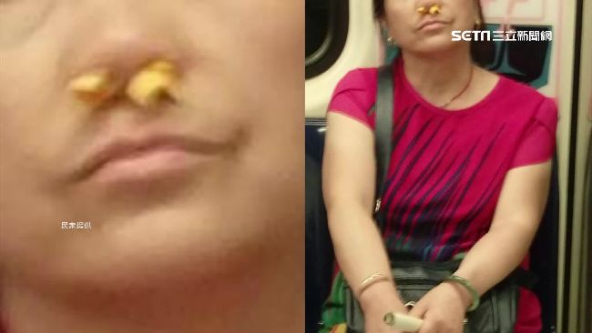 這哪招？婦人搭捷運　鼻孔竟塞橘子皮