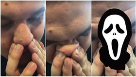 粉刺,黑頭,擠壓,蟲,鼻子,除粉刺　圖／翻攝自YouTube影片https://goo.gl/yrp9lb