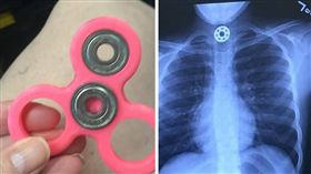  美國女孩誤食指尖陀螺（圖／翻攝自臉書The Feels） https://www.facebook.com/thefeelstv/photos/pcb.404372796611609/404372636611625/?type=3&theater