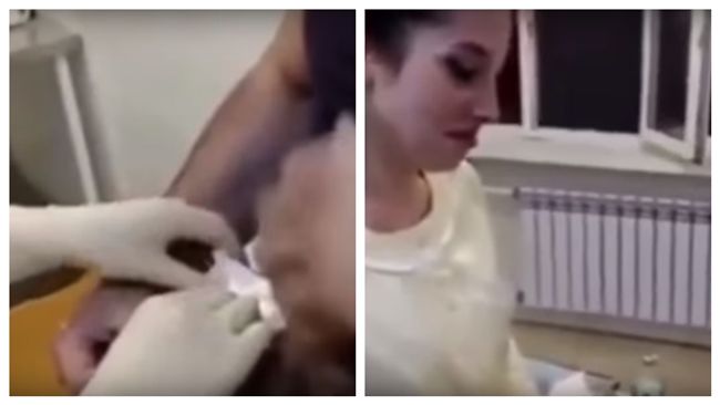 另類求婚！從男友腹部拿出血淋淋戒指
