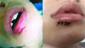 大陸,IKEA,爆裂,水杯,杯子,爆炸,嘴巴,受傷
http://weibo.com/finance?refer_flag=1001030103_